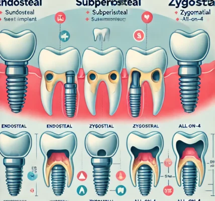 Dall·e 2024 09 15 20.38.46 An Illustration Showing The Four Types Of Dental Implants Endosteal, Subperiosteal, Zygomatic, And All On 4. The Image Should Display A Comparison Of